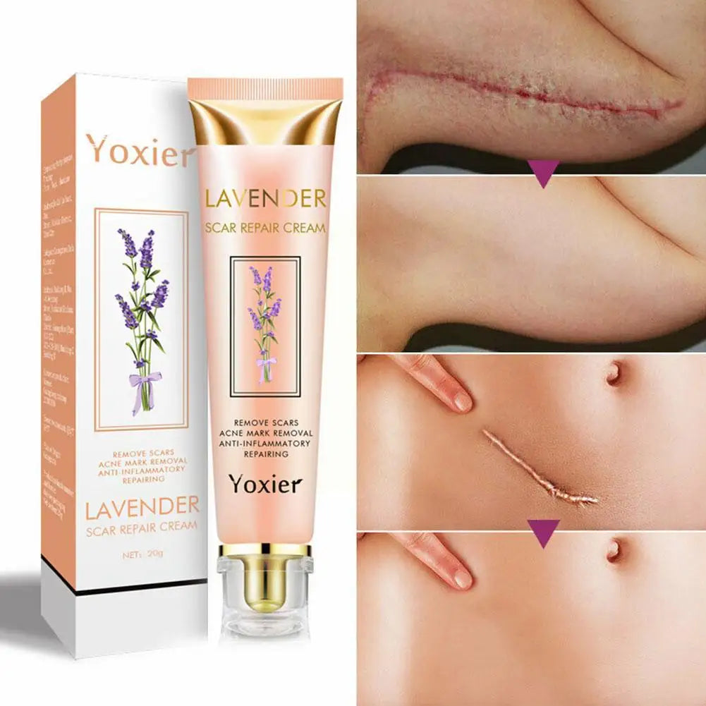 Yoxier Lavender Scar Repair Cream Acne Scar Removal Skin Stretch Pigmentation Marks Smooth Remove Scar Care Whitening Corre H8U4